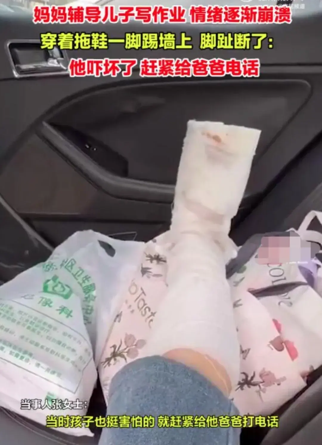 女子輔導(dǎo)兒子作業(yè)情緒崩潰踹斷腳趾
