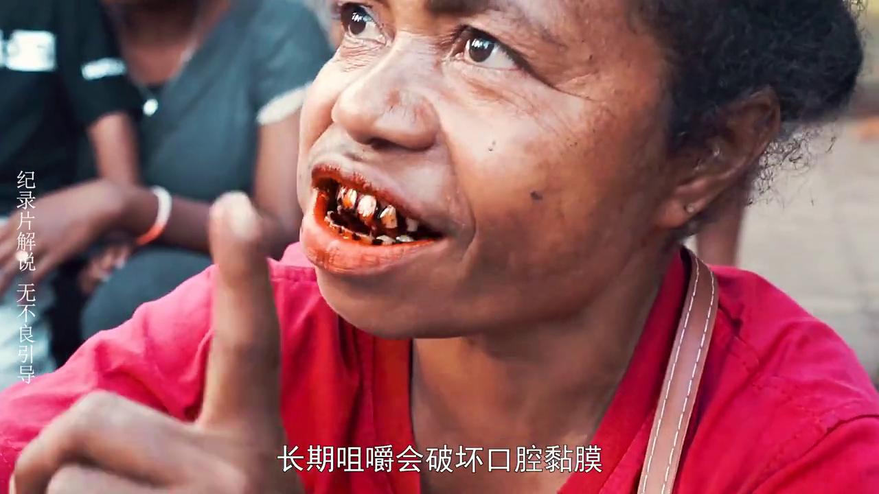 小伙嚼檳榔8年瓜子臉變方塊臉