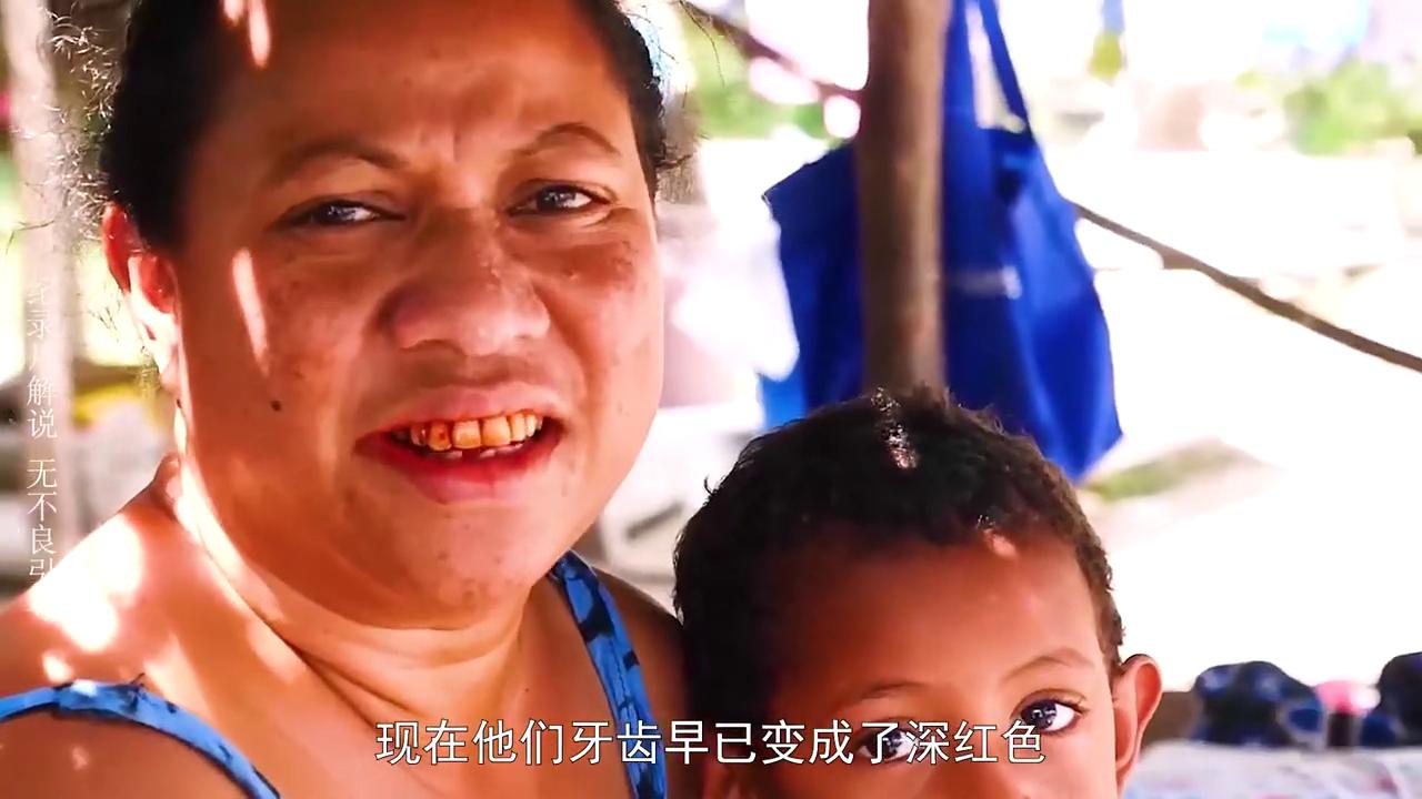 小伙嚼檳榔8年瓜子臉變方塊臉